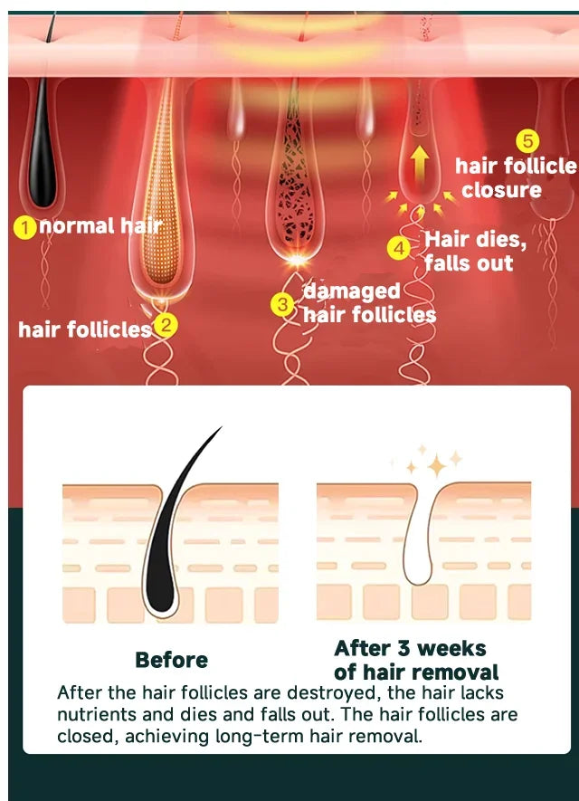 Épilateur laser IPL permanent Dépilatrices pour femmes Machine de rasage et de coupe de cheveux Rasoir et tondeuse pour hommes Épilation laser
