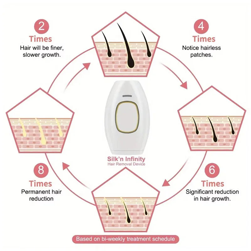 Appareil de beauté pour le rajeunissement de la peau et l'élimination des marques par photons, pour l'épilation à domicile, rasoir pour l'épilation des poils du maillot.