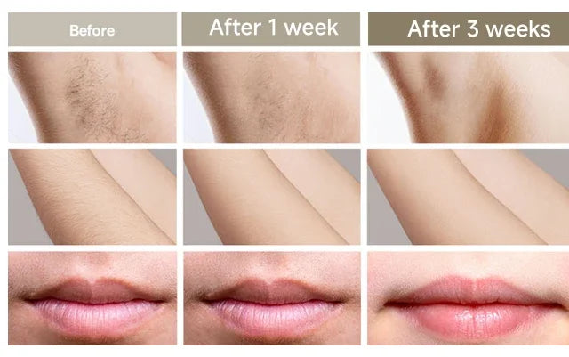 Épilateur laser IPL permanent Dépilatrices pour femmes Machine de rasage et de coupe de cheveux Rasoir et tondeuse pour hommes Épilation laser