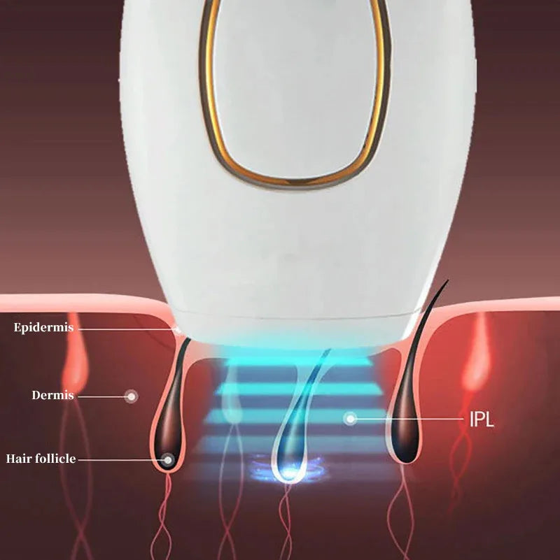 Appareil de beauté pour le rajeunissement de la peau et l'élimination des marques par photons, pour l'épilation à domicile, rasoir pour l'épilation des poils du maillot.