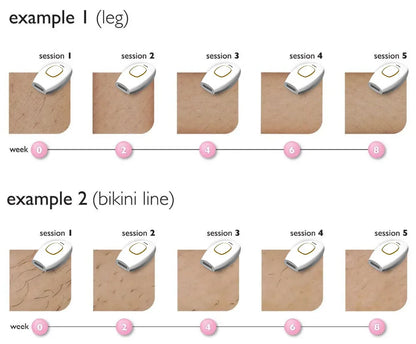 Appareil de beauté pour le rajeunissement de la peau aux photons et l'élimination des marques pour l'utilisation à domicile, rasoir pour l'épilation des poils de bikini