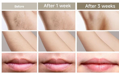 Épilateur laser IPL permanent Dépilatrices pour femmes Machine de rasage et de coupe de cheveux Rasoir et tondeuse pour hommes Épilation laser